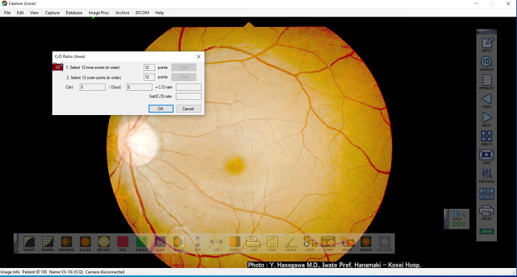 NEGATIVE button on the toolbar